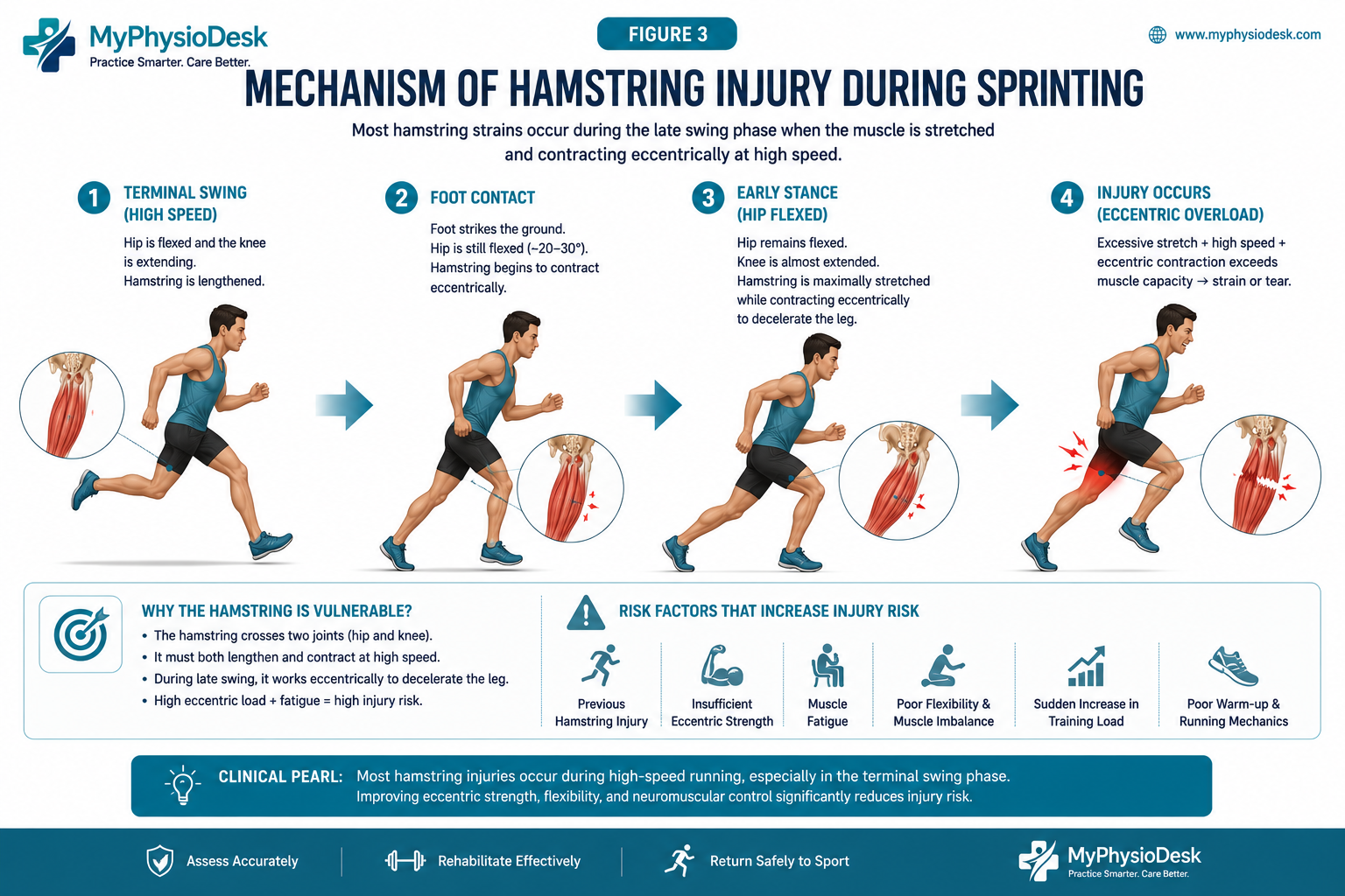 Hamstring palpation assessment by physiotherapist